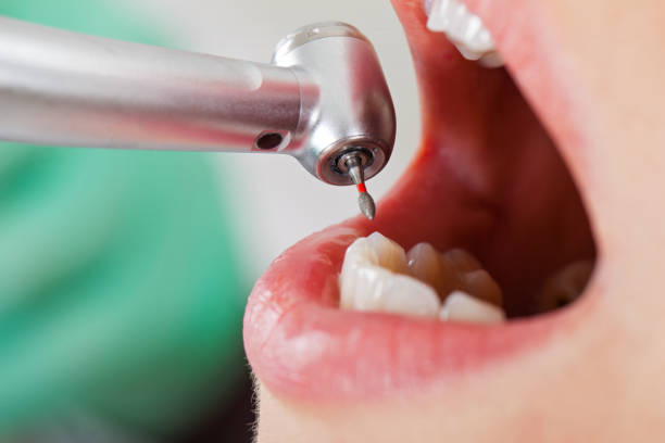 Best Cosmetic Emergency Dentistry in Fond Du Lac, WI